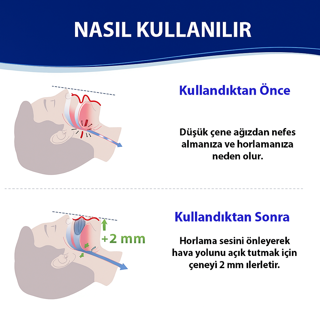 Hormonex®-HORLAMA ENGELLEYİCİ AĞIZLIK