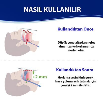 Hormonex®-HORLAMA ENGELLEYİCİ AĞIZLIK
